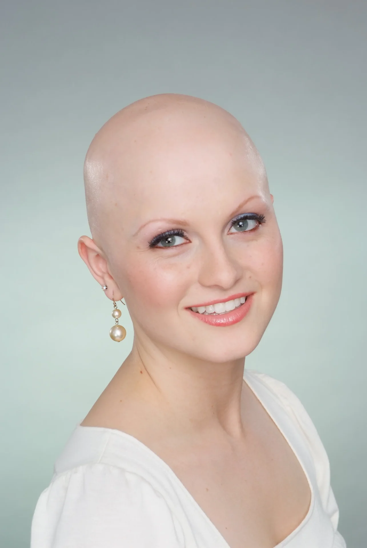 A Woman With Bald Head in a White Color Top