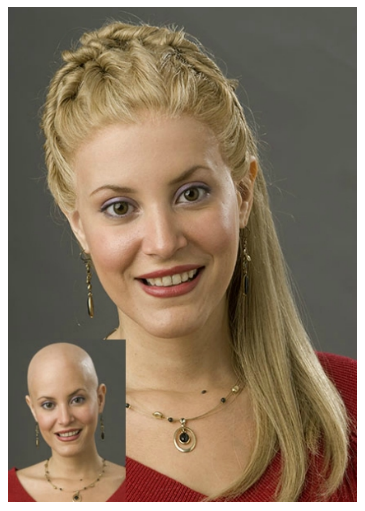 A Woman With a Braid With a Bald Head