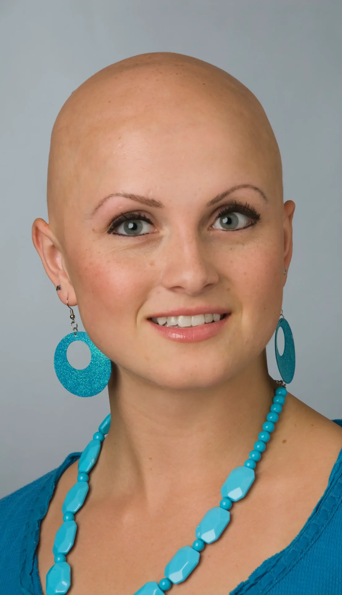 A Woman With a Bald Head in Blue
